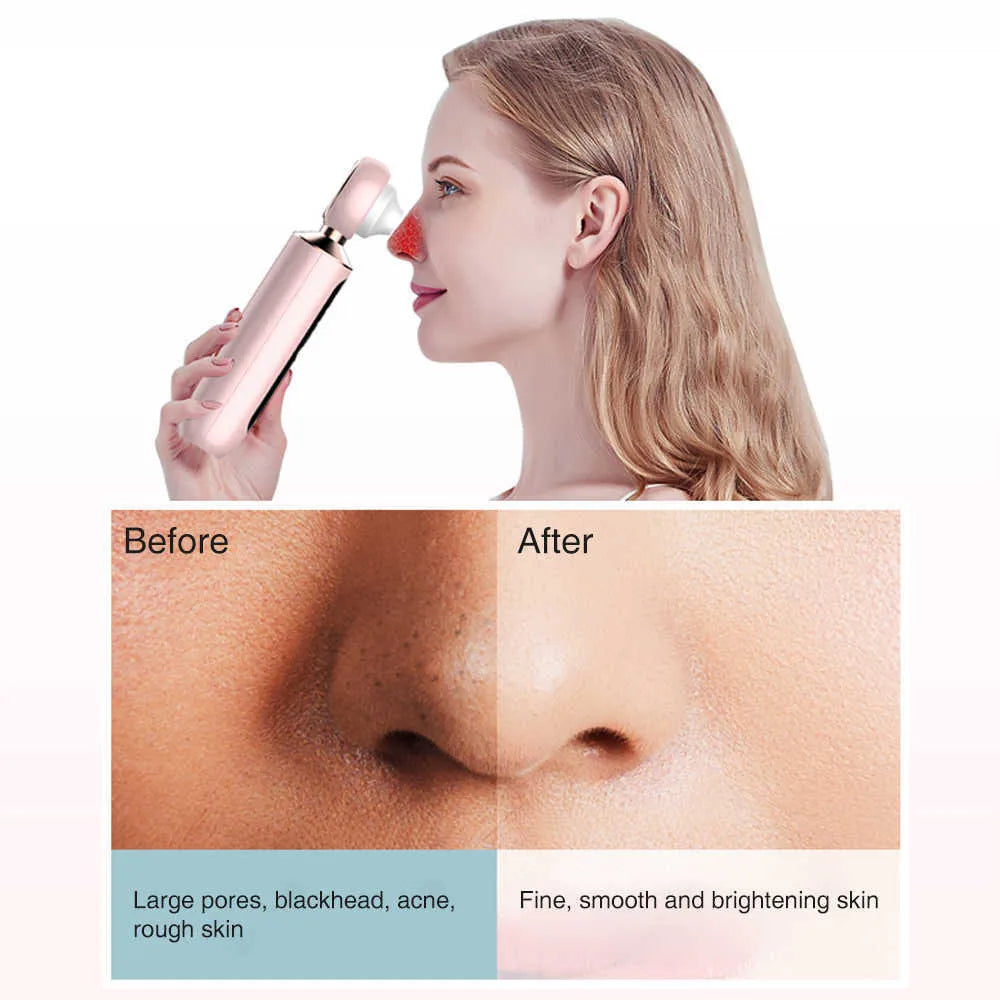 Glowedge™ Blackhead Suction Machine