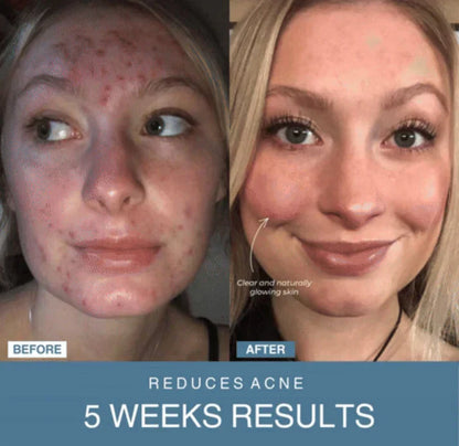 Glowedge™ 7-in-1 LED Anti-Aging/Wrinkle Apparatus